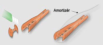 Kostřička na uchycení amortizéru v děličce